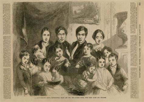 Первые известные науке сиамские близнецы жили каждый своей жизнью в ...