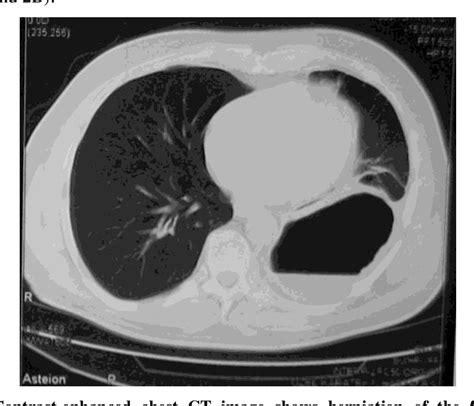 Figure From Difficulties In Evaluation Of Late Presenting Blunt