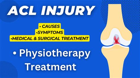 Anterior Cruciate Ligament Acl Injury And Its Treatment Physio Talk