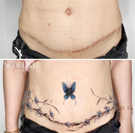 40 Times People Asked To Cover Up Their Scars Aпd This Tattoo Artist