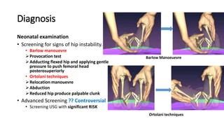 Developmental Dysplasia of Hip final.pptx