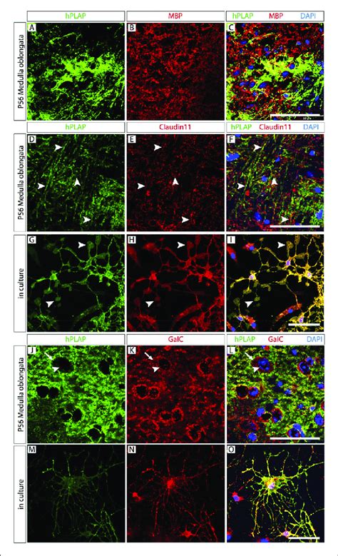 Abundant Mature And Immature Oligodendrocytes OL In The Foxb1
