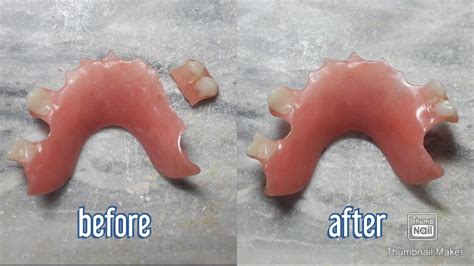 How To Fix A Broken Denture Youtube