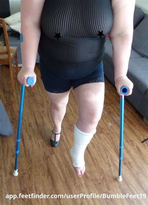 More Leg Cast Foot Fetish And Bbw Belly Show Off 8 Nude Pics XHamster