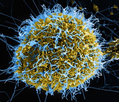 Ebolafieber - DocCheck Flexikon