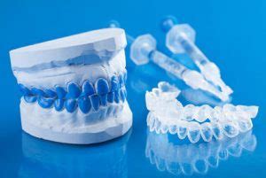 Benefits of custom whitening trays – Even28: Dentist Search Engine