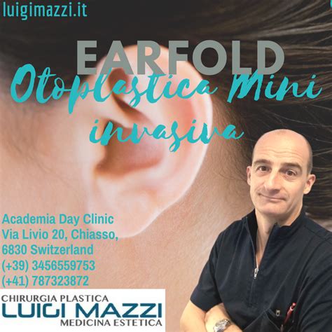 Dr Luigi Mazzi Earfold Otoplastica Mini Invasiva Chirurgia