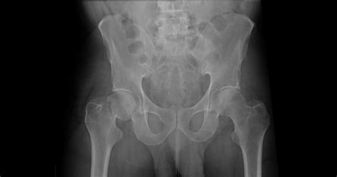 Статьи компании МосРентген Центра