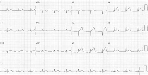 Manual Of Medicine On Twitter A Year Old Man Presents To The