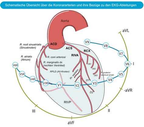 Der linke Ventrikel bei Myokardischämie und infarkt EKG ECHO