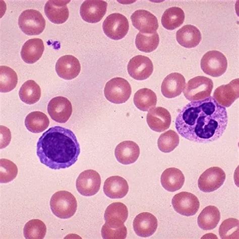 book giemsa stain test price  delhi cost   india ganesh