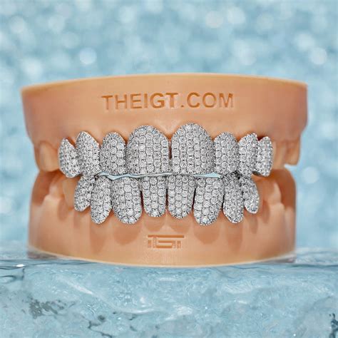 Custom Grillz – ICEGIANT