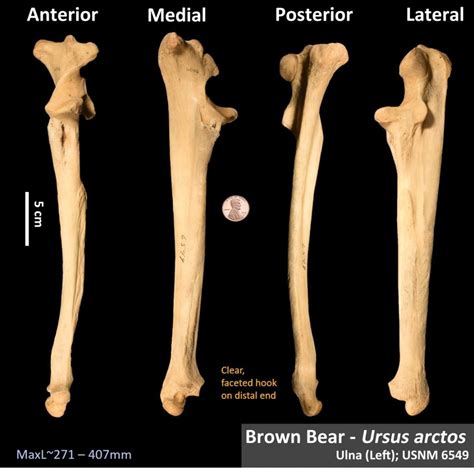 Bones Osteoid Bone Identification