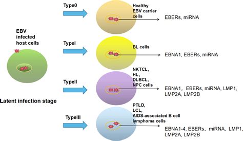 Frontiers Treatment Advances In Ebv Related Lymphoproliferative Diseases