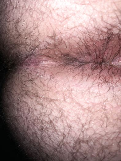 My Ass Album Image ThisVid Tube