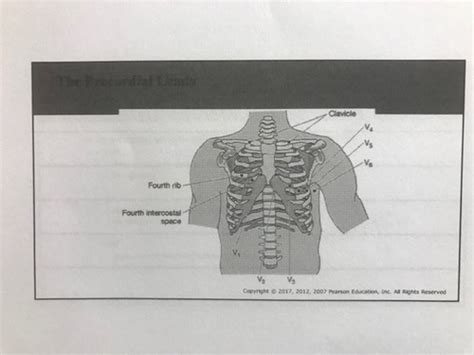 Ekg Lead Morphology And Placement Flashcards Quizlet