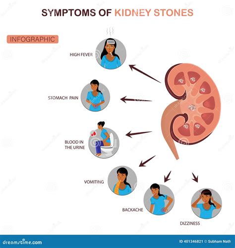 Symptoms Of Stones In The Gallbladder. Infographics. Vector