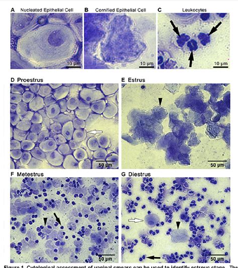 PDF Performing Vaginal Lavage Crystal Violet Staining And Vaginal