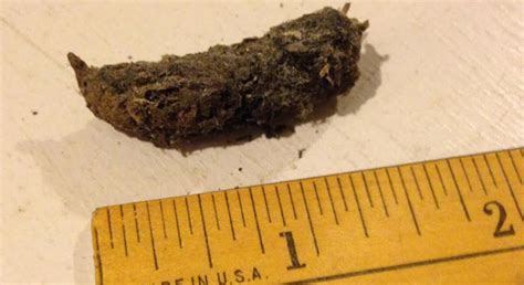 Worms In Human Diarrhea
