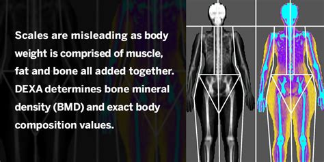 Dexa Body Fat Measurement Body Measurement Info