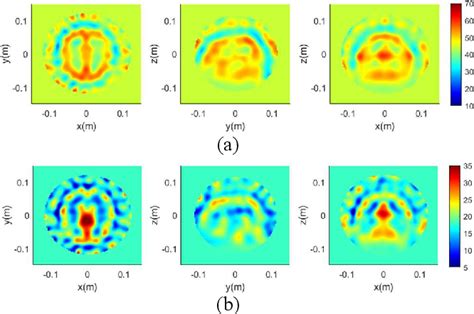 Figure 1 From A Feature Based Inversion Method For Brain Stroke