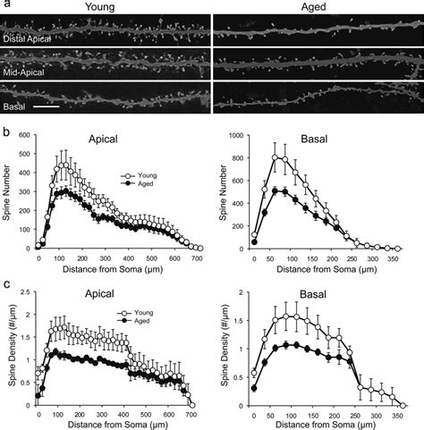 The number and density of dendritic spines are significantly reduced in ...