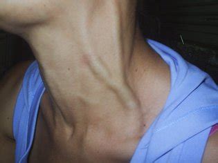 Neck Veins Luscious Hentai Manga Porn