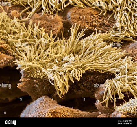 Lung lining. Coloured scanning electron micrograph (SEM) of a section ...