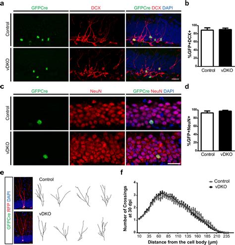 Virally Labeled NPCs Can Differentiate Into Mature Granule Neurons In
