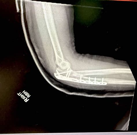 Sweetlilpics - If you are wondering why it's been so quiet here is why