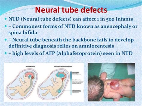 Biochemical Markers Of Prenatal Diagnosis