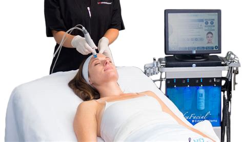 Лучшие аппараты для газожидкостного пилинга на 2025 год