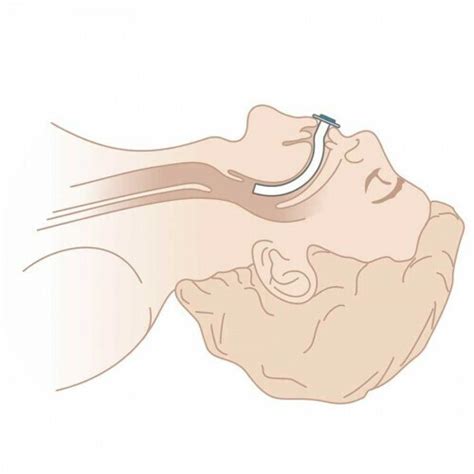 Воздуховод ротоглоточный полимерный стерильный №2 (80 мм, зелёный ...