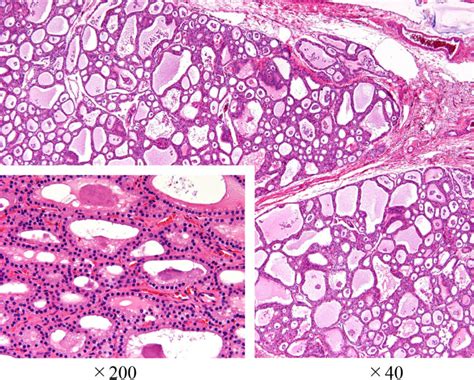 Hematoxylin And Eosin Staining Of Thyroid Tissue Download Scientific