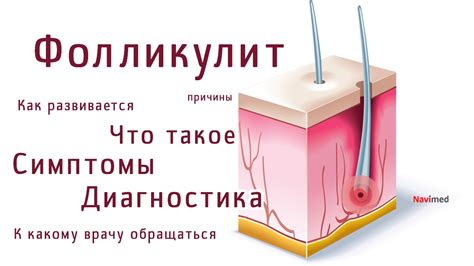Что такое фолликулит волосистой части как головы так и тела. Обзор ...