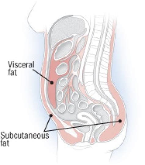 Visceral vs. subcutaneous fat - MennoHenselmans.com