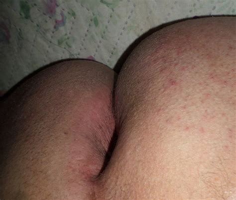 My Ass Ready For A Cock 33 Nude Pics XHamster