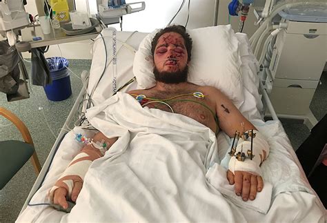 Sex dögum síðar vaknaði ég á spítala frekar laskaður