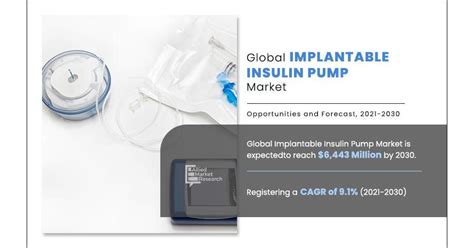 Implantable Insulin Pump Market Report Latest Trends And Future Opportunities Analysis 2024 2030