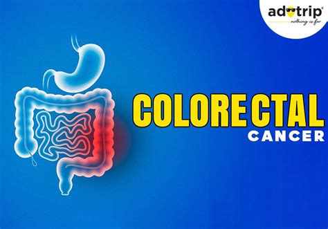 Colorectal Cancer Causes Symptoms And Treatment Options