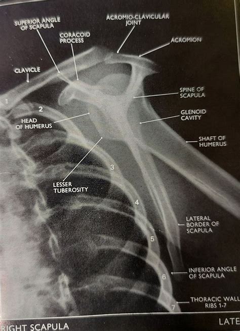 X Ray Shoulder Anatomy