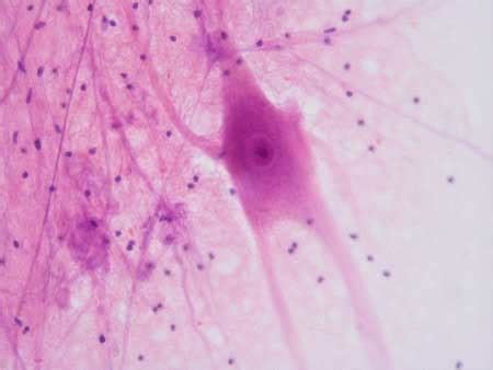 Motor Neuron Smear Diagram Quizlet