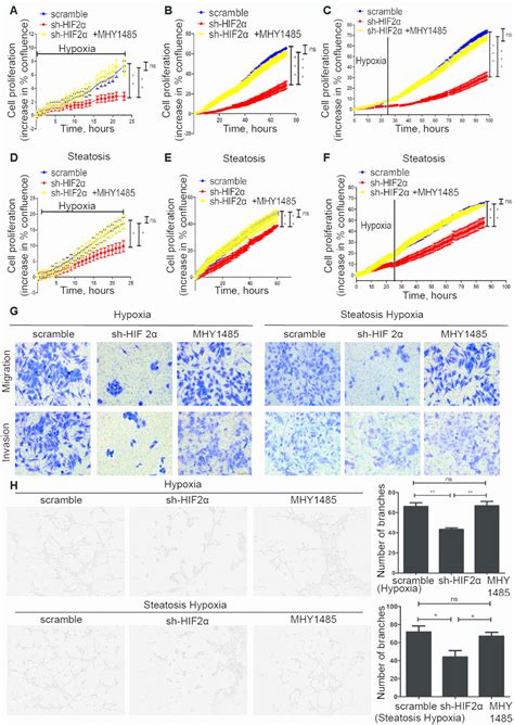 HIF 2α upregulation mediated by hypoxia promotes NAFLD HCC progression