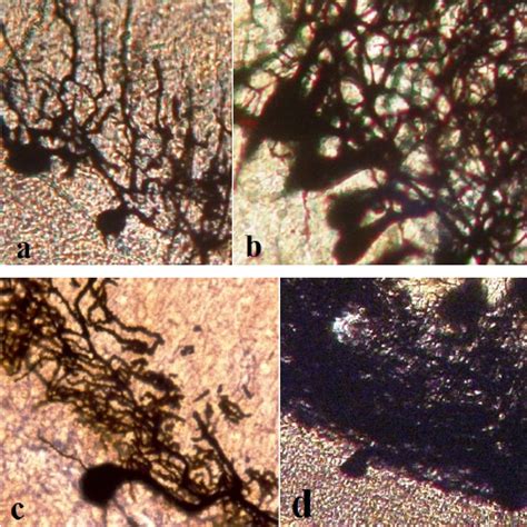 A D Purkinje Cells Of The Human Cerebellum In Golgi Staining A