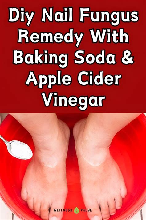 Pin On Toenail Fungal Infection