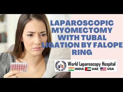 Laparoscopic Myomectomy With Tubal Ligation By Falope Ring Youtube