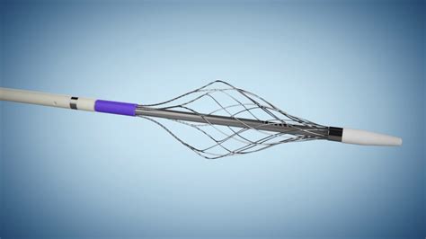 FDA Clears Vetex ReVene Thrombectomy Catheter Medlatest Medical