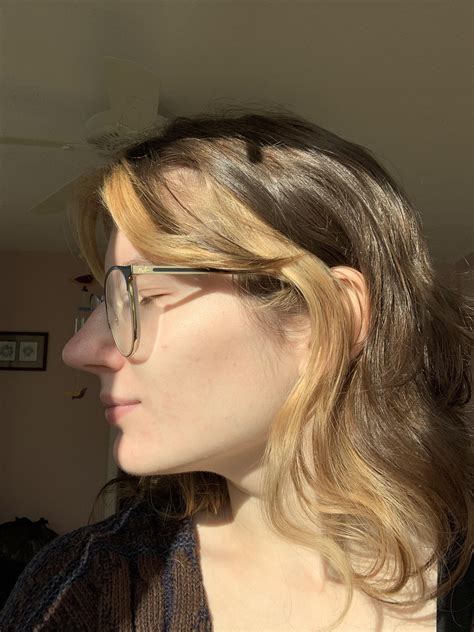 I still have bad skin days but I’m proud of the progress [B&A] : r