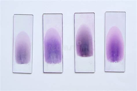 20 Blood Smear Free Stock Photos Stockfreeimages