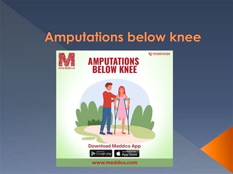 amputations  knee powerpoint